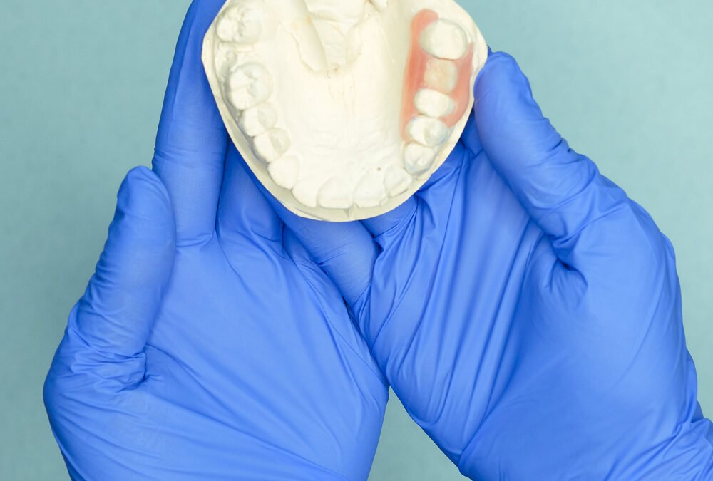 Protesi totale o parziale