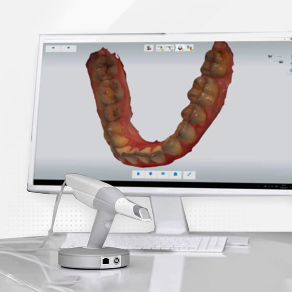 scanner-intraorale-3d-